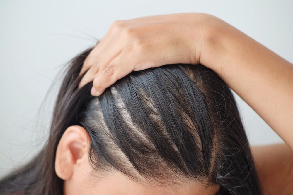 What to do About Hair Loss and Thinning | Marchelle Salone | Arlington, MA